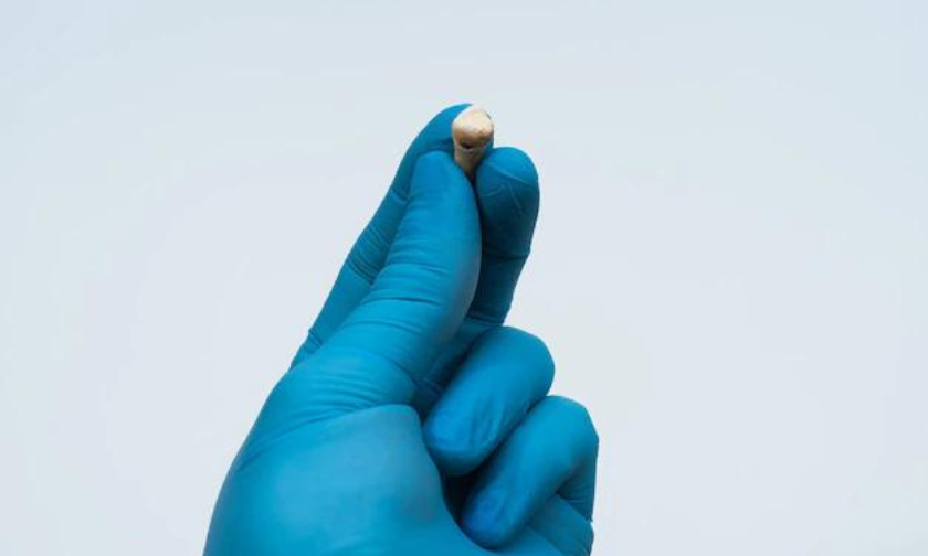 Featured image for “Tooth Extraction: What to Know Before You Go Under The Knife”