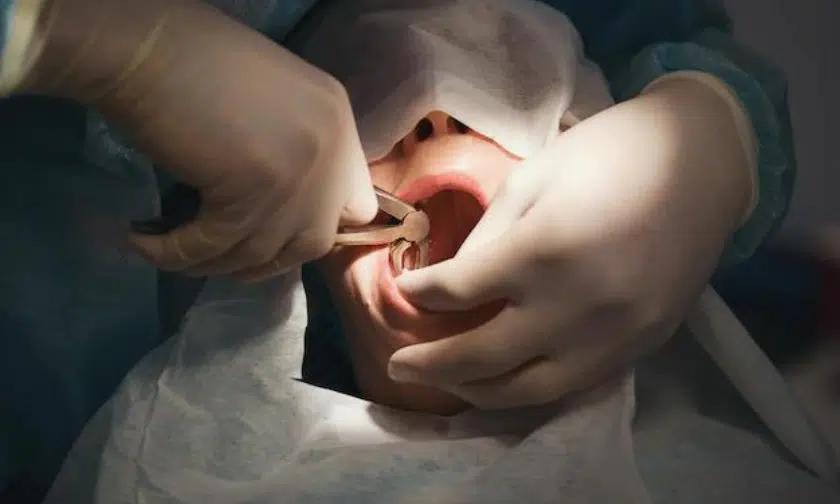 Featured image for “Possible Complications After a Tooth Removal & How to Avoid Them”