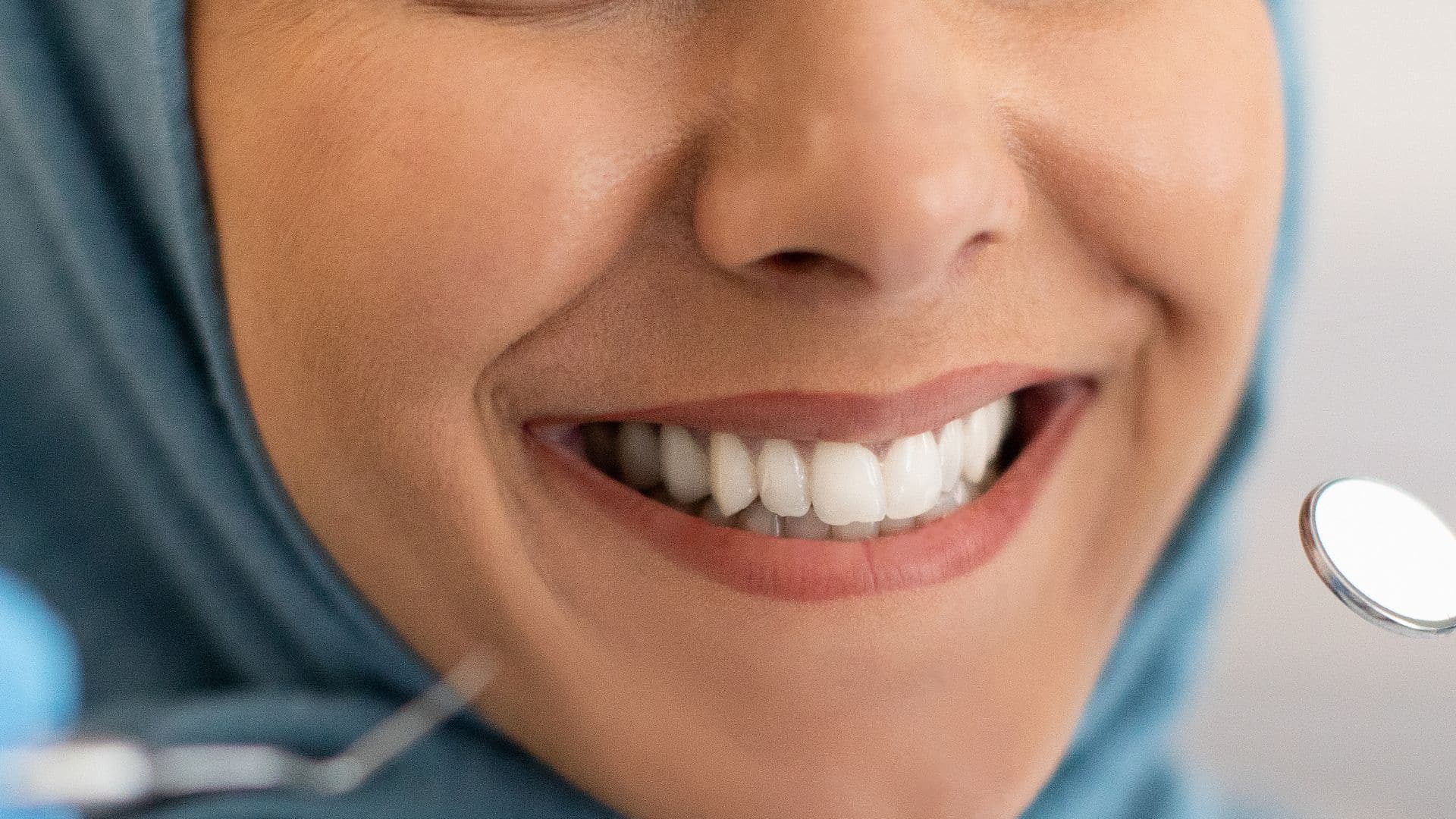 Featured image for “Cosmetic Smile Makeover: What To Expect?”