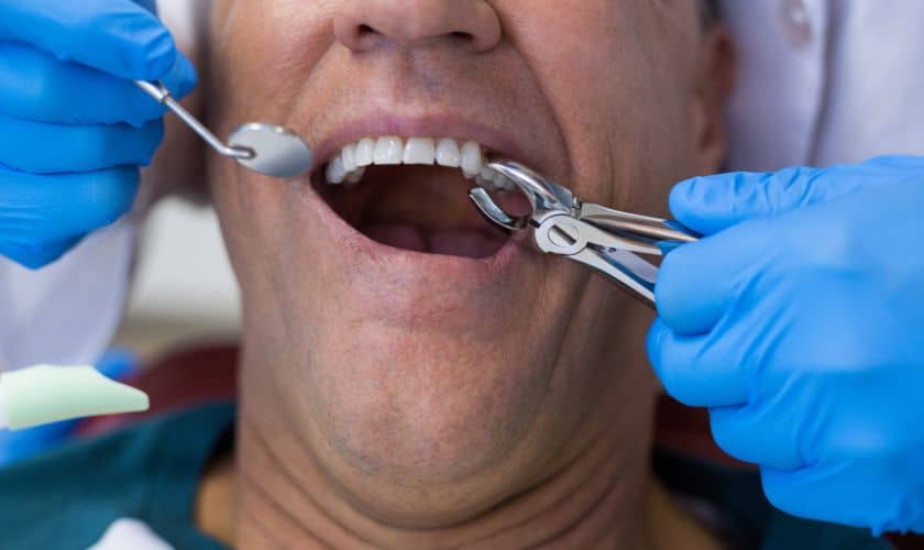Featured image for “What To Expect During A Tooth Extraction Procedure In Sharpsville”