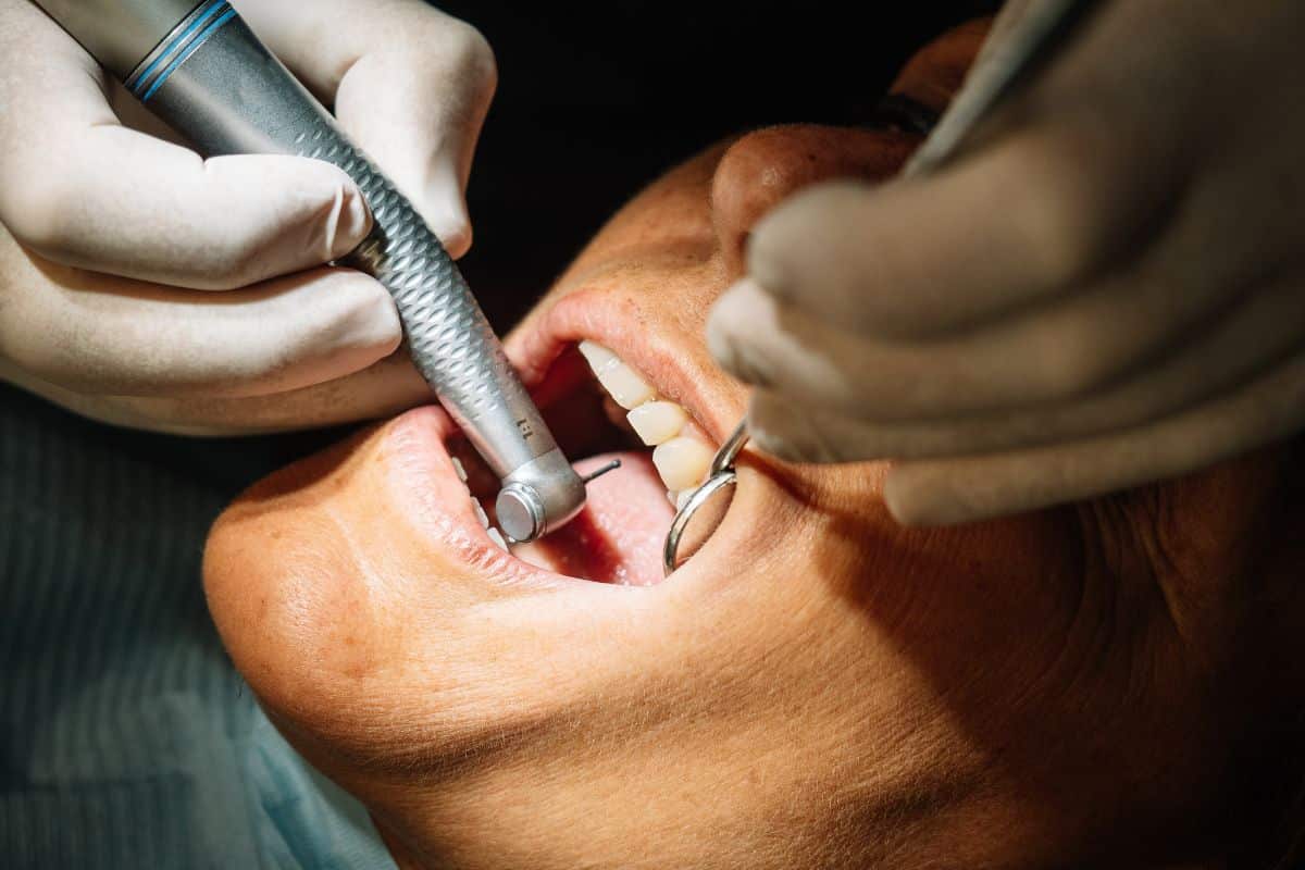 Featured image for “How Long Does a Full Mouth Restoration Take?”