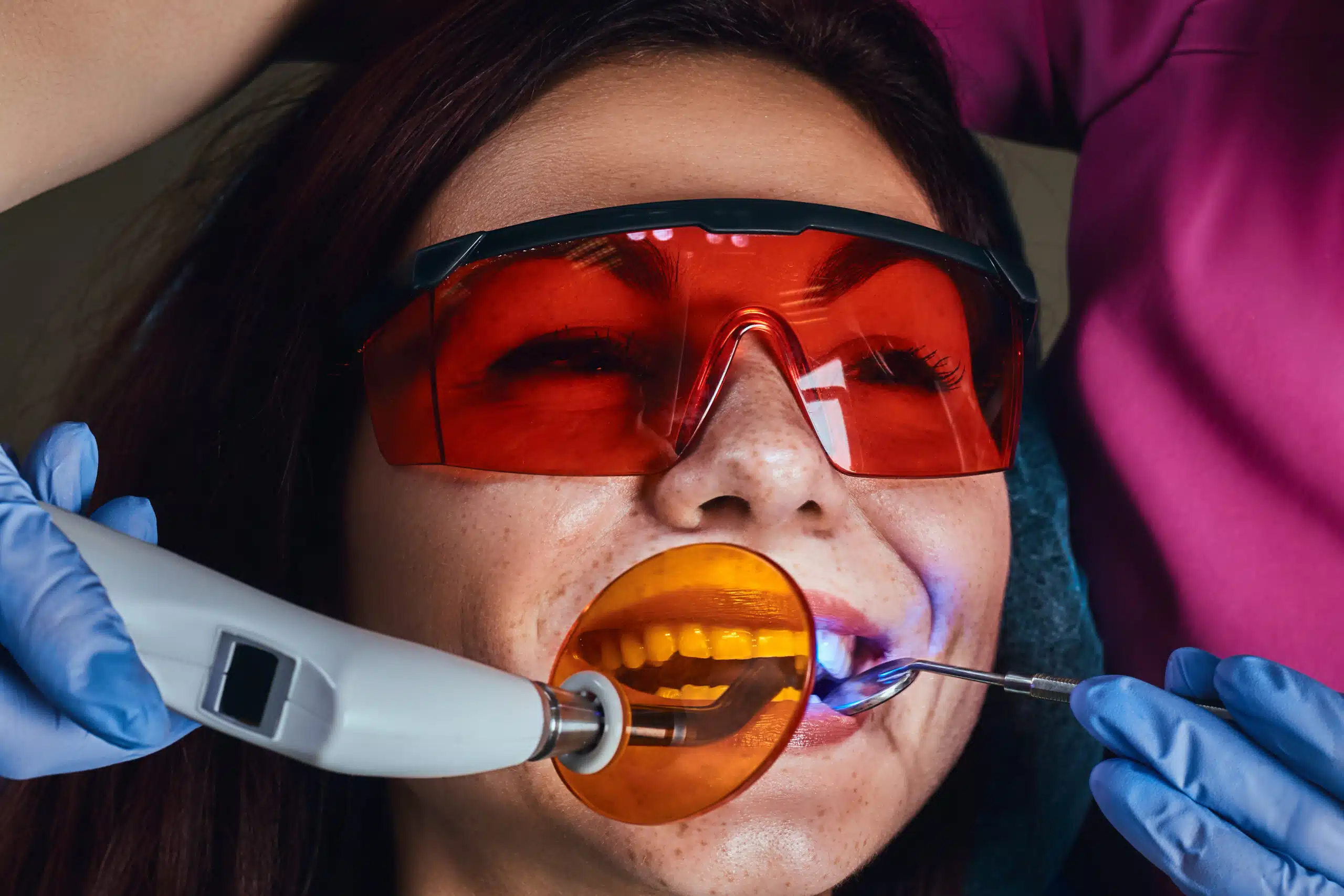 Featured image for “Keep Your Whitened Teeth Bright: The Maintenance Guide Dentists Recommend”
